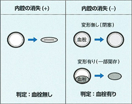 Ö@ɂ锻