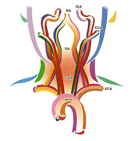 総頸動脈系