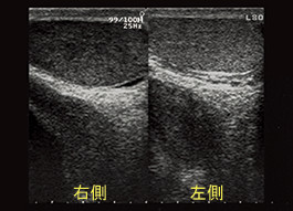 Chapter 4 精巣 陰嚢の病変 Hitachi Aloka Medical 超音波検査法セミナー