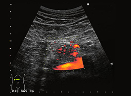 危険因子と原因